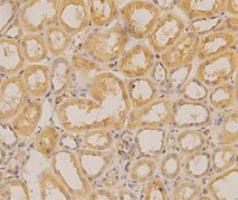 Anti-AHSG Mouse Monoclonal Antibody [clone: 20]