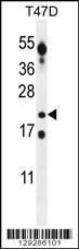 Anti-CT45A Rabbit Polyclonal Antibody (HRP (Horseradish Peroxidase))