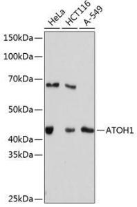 Western blot analysis of extracts of various cell lines, using Anti-MATH1/HATH1 Antibody [ARC0609] (A80815) at 1:1000 dilution. The secondary Antibody was Goat Anti-Rabbit IgG H&L Antibody (HRP) at 1:10000 dilution. Lysates/proteins were present at 25 µg per lane