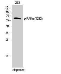 Western blot analysis of 293 cells using Anti-PAK1 (phospho Thr212) Antibody