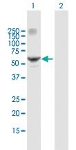 Anti-RARG Mouse Polyclonal Antibody