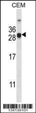 Anti-CIDEA Rabbit Polyclonal Antibody (APC (Allophycocyanin))