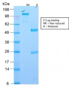 SDS-PAGE analysis of Anti-EpCAM Antibody [EGP40/2571R] under non-reduced and reduced conditions; showing intact IgG and intact heavy and light chains, respectively. SDS-PAGE analysis confirms the integrity and purity of the antibody.