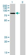 Anti-LIMK2 Mouse Monoclonal Antibody [clone: 2H2-E11]