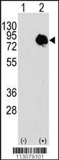 Anti-Transglutaminase Rabbit Polyclonal Antibody (APC (Allophycocyanin))