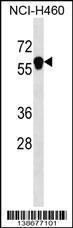 Anti-ANKDD1B Rabbit Polyclonal Antibody (Biotin)