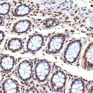 Immunohistochemistry analysis of paraffin-embedded human colon tissue using Anti-Histone H4 Antibody [ARC2340] (A308423) at a dilution of 1:100 (40X lens). Perform microwave antigen retrieval with 10 mM Tris/EDTA buffer pH 9.0 before commencing with IHC staining protocol