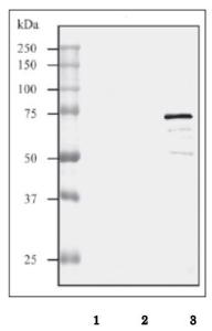 Anti-Streptolysin O Antibody