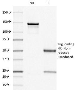 SDS-PAGE analysis of Anti-Estrogen Receptor Antibody [ER505] under non-reduced and reduced conditions; showing intact IgG and intact heavy and light chains, respectively. SDS-PAGE analysis confirms the integrity and purity of the Antibody