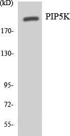 Anti-PIP5K3 Rabbit Polyclonal Antibody