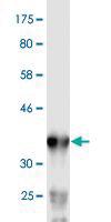 Anti-PNMA1 Mouse Monoclonal Antibody [clone: 1C3]