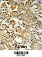 Anti-XBP1 Rabbit Polyclonal Antibody (HRP (Horseradish Peroxidase))