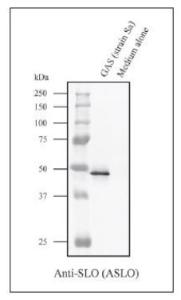 Anti-Streptolysin O Antibody