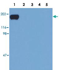 Anti-EGFR Mouse Monoclonal Antibody [clone: EM-12]