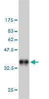 Anti-DAPK2 Mouse Monoclonal Antibody [clone: 3D4]