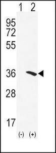 Anti-NAT2 Rabbit Polyclonal Antibody