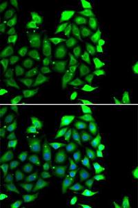 Anti-IKZF3 antibody