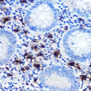 Immunohistochemistry analysis of paraffin-embedded human appendix tissue using Anti-Mast Cell Chymase Antibody [ARC0614] (A80816) at a dilution of 1:100 (40x lens)