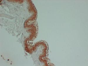 Anti-Cytokeratin 1 antibody