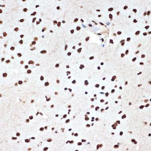 Immunohistochemistry analysis of paraffin-embedded rat brain using Anti-SET/TAF-I Antibody [ARC1462] (A305799) at a dilution of 1:100 (40X lens). Perform microwave antigen retrieval with 10 mM Tris/EDTA buffer pH 9.0 before commencing with IHC staining protocol