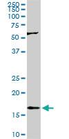 Anti-RHEB Mouse Monoclonal Antibody [clone: 2C11]