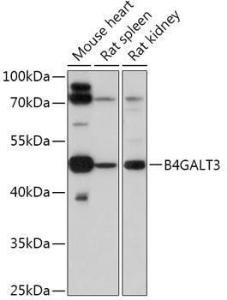 Western blot analysis of extracts of various cell lines, using Anti-B4GALT3 Antibody (A308424) at 1:1,000 dilution