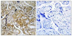 Immunohistochemical analysis of paraffin-embedded human placenta using Anti-PAK1 (phospho Ser199) Antibody. The right hand panel represents a negative control, where the antibody was pre-incubated with the immunising peptide