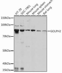 Anti-GOLPH2 antibody