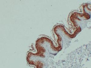 Anti-Cytokeratin 1 antibody