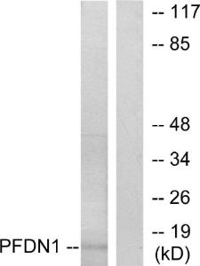 Western blot analysis of lysates from RAW264.7 cells using Anti-PFDN1 Antibody. The right hand lane represents a negative control, where the antibody is blocked by the immunising peptide