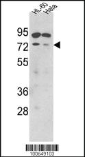 Anti-SENP1 Rabbit Polyclonal Antibody