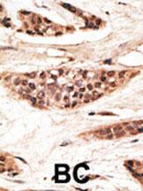 Anti-TAP1 Rabbit Polyclonal Antibody