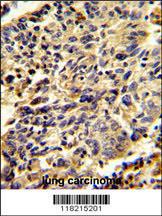 Anti-GPC1 Rabbit Polyclonal Antibody