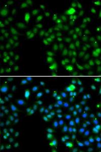 Antibody anti-ING5 100 µl