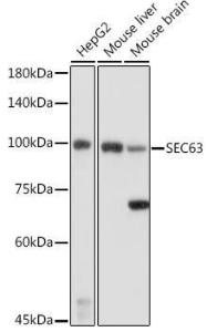 Western blot analysis of extracts of various cell lines, using Anti-SEC63 Antibody (A308425) at 1:1000 dilution. The secondary Antibody was Goat Anti-Rabbit IgG H&L Antibody (HRP) at 1:10000 dilution. Lysates/proteins were present at 25 µg per lane