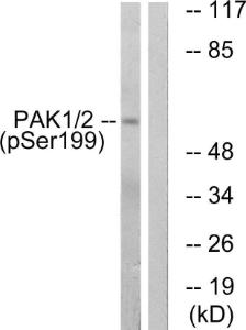 Western blot analysis of lysates from LOVO cells treated with starved 24h using Anti-PAK1 (phospho Ser199) Antibody. The right hand lane represents a negative control, where the antibody is blocked by the immunising peptide