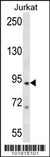 Anti-TAP1 Rabbit Polyclonal Antibody