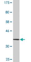 Anti-TRIM17 Mouse Monoclonal Antibody [clone: 2D3]