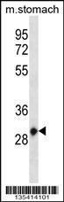 Anti-HOXC12 Rabbit Polyclonal Antibody (Biotin)