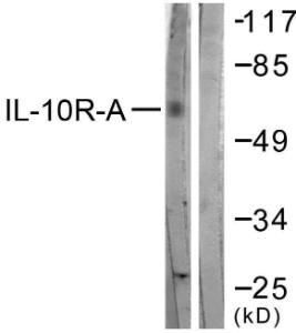 Western blot analysis of lysates from HepG2 cells, treated with Na2VO3 0.3nM 40' using Anti-IL-10R alpha Antibody. The right hand lane represents a negative control, where the antibody is blocked by the immunising peptide