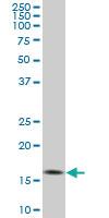 Anti-RHEB Mouse Monoclonal Antibody [clone: 2C11]