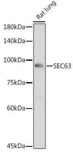 Western blot analysis of extracts of Rat lung, using Anti-SEC63 Antibody (A308425) at 1:1000 dilution. The secondary Antibody was Goat Anti-Rabbit IgG H&L Antibody (HRP) at 1:10000 dilution. Lysates/proteins were present at 25 µg per lane