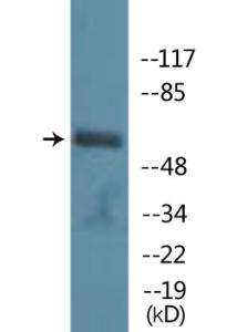 Western blot analysis of lysates from LOVO cells treated with starved 24h using Anti-PAK1 (phospho Ser199) Antibody