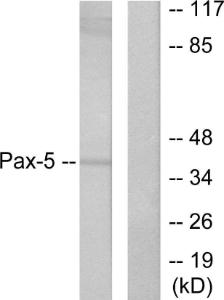 Western blot analysis of lysates from 293 cells using Anti-Pax-5 Antibody. The right hand lane represents a negative control, where the antibody is blocked by the immunising peptide