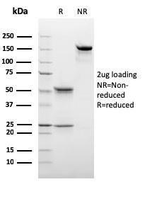 SDS-PAGE analysis of Anti-C1QB Antibody [C1QB/2966] under non-reduced and reduced conditions; showing intact IgG and intact heavy and light chains, respectively. SDS-PAGE analysis confirms the integrity and purity of the antibody.