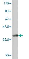 Anti-CDC42BPG Mouse Polyclonal Antibody