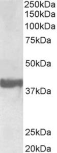 EB11694 (0.3 µg/ml) staining of Human Frontal Cortex lysate (35 µg protein in RIPA buffer). Primary incubation was 1 hour. Detected by chemiluminescence.