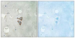 Immunohistochemical analysis of paraffin-embedded human brain tissue using Anti-Opioid Receptor-delta Antibody. The right hand panel represents a negative control, where the antibody was pre-incubated with the immunising peptide