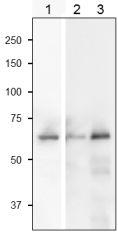 Anti-Sulfite Reductase Antibody