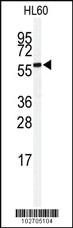 Anti-SENP2 Rabbit Polyclonal Antibody